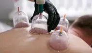 Hacamat Herkese Uygun mu? Doktorlar Risklere Dikkat Çekti