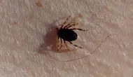 Sivas’ta kene nedeniyle 6. ölüm
