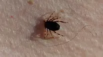Sivas’ta kene nedeniyle 6. ölüm