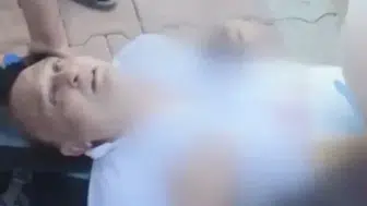 Bıçaklı saldırıda yaralanan Yeni Parti Milletvekili Melih Meriç entübe edildi