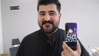 Sivas’ta Eypio’ya Benzeyen Diş Hekimi İlgi Odağı Oldu