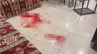 Çay Ocağındaki Bıçaklı Saldırıda Acı Haber: Ağır Yaralı Şahıs Öldü!