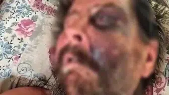 Darbedilen adam, metruk evde ölüme terk edildi