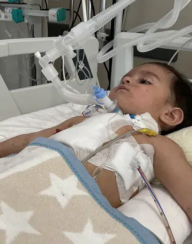 1 Yaşındaki Bebeğin Akciğerindeki Ceviz Çıkarıldı!