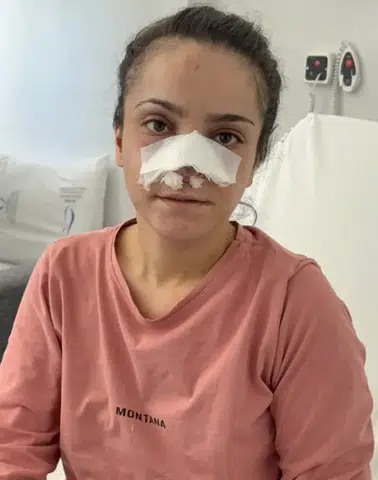 Manisa'da Canice Saldırıya Uğrayan Kadın Konuştu! Can Havliyle Balko...