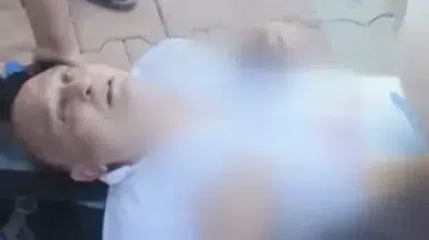 Bıçaklı saldırıda yaralanan Yeni Parti Milletvekili Melih Meriç entübe edildi