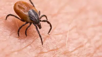 Bir Kene Daha Can Aldı! Sivas’ta KKKA Şüphesiyle Tedavi Gören Genç Hayatını Kaybetti