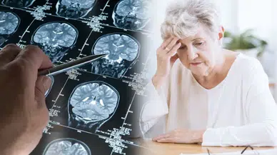 Alzheimer'ın ilk izleri unutkanlıktan yıllar önce ortaya çıkıyor