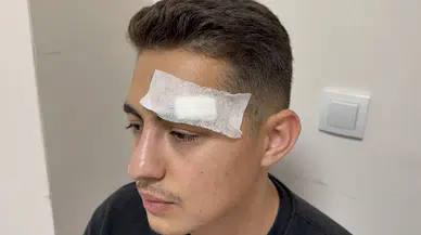 Hastanede Dehşet: Hasta Yakını Su Isıtıcısıyla Saldırdı!