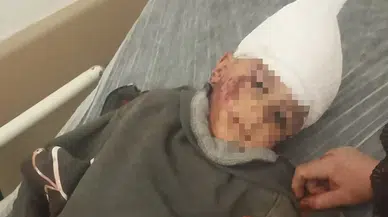 Köpek Saldırısına Uğrayan 3 Yaşındaki Çocuk Yaşam Savaşı Veriyor