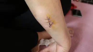 Eşi Tarafından 30 Yerinden Bıçaklanan Kadına Şok Şikayet Geri Çekme Talebi