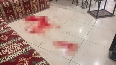 Çay Ocağındaki Bıçaklı Saldırıda Acı Haber: Ağır Yaralı Şahıs Öldü!