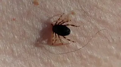 Sivas’ta kene nedeniyle 6. ölüm