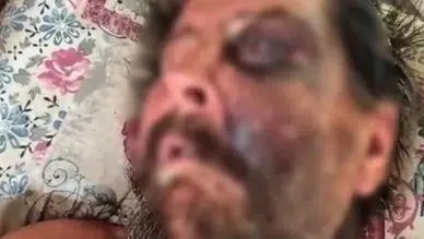 Darbedilen adam, metruk evde ölüme terk edildi