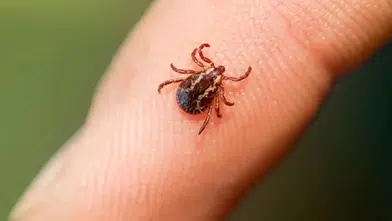 Sivas'ta KKKA hastalığı şüphesiyle tedavi gören kadın öldü
