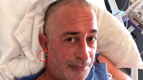 Sivaslı Komedyen kalp krizi geçirdi! Herkes kulak memesindeki o detayı konuşuyor