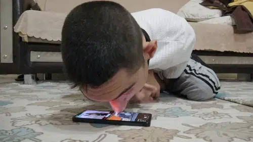 Yüzde 95 Engelli Osman Burnuyla Telefona Dokunup Hayata Tutundu