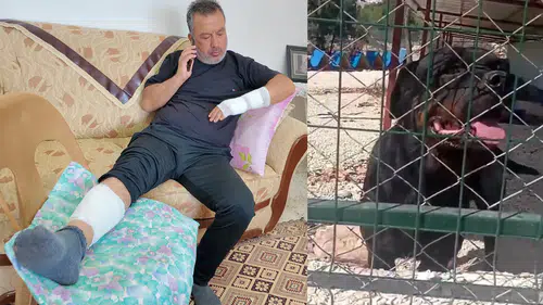 Rottweiler Faciası: Sahipli Rottweiler Sokakta Dehşet Saçtı!
