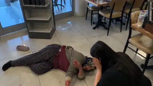 Tekmelere aldırmayan köpek kadının kolunu kopardı