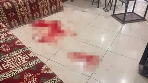Çay Ocağındaki Bıçaklı Saldırıda Acı Haber: Ağır Yaralı Şahıs Öldü!