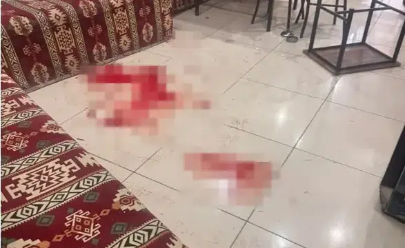 Çay Ocağındaki Bıçaklı Saldırıda Acı Haber: Ağır Yaralı Şahıs Öldü!