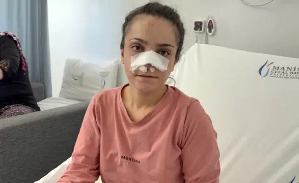 Manisa'da Canice Saldırıya Uğrayan Kadın Konuştu! Can Havliyle Balko...