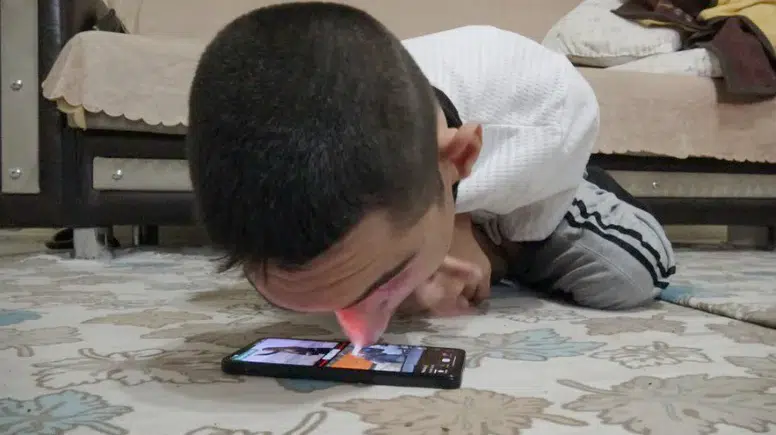 Yüzde 95 Engelli Osman Burnuyla Telefona Dokunup Hayata Tutundu