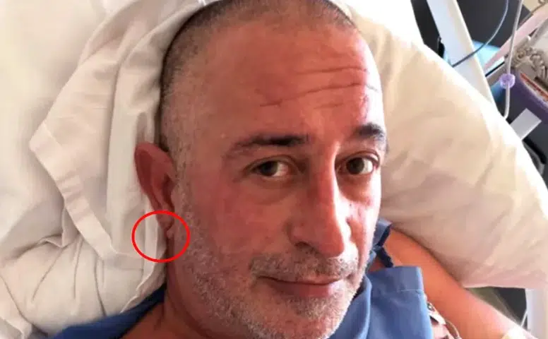 Sivaslı Komedyen kalp krizi geçirdi! Herkes kulak memesindeki o detayı konuşuyor