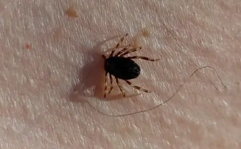 Sivas’ta kene nedeniyle 6. ölüm