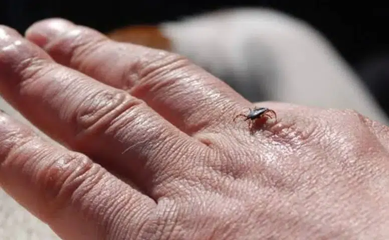 Sivas’ta Kene Vakası Can Aldı: Ordu’dan Nakledilen Kadın Hayatını Kaybetti