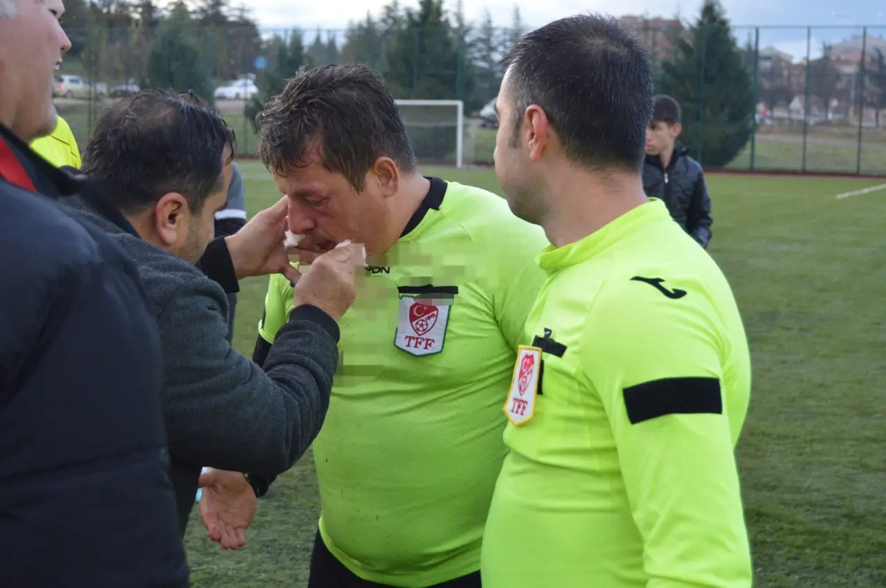 Eskişehir’de maç ortasında şiddet: Hakem kanlar içinde kaldı! 2