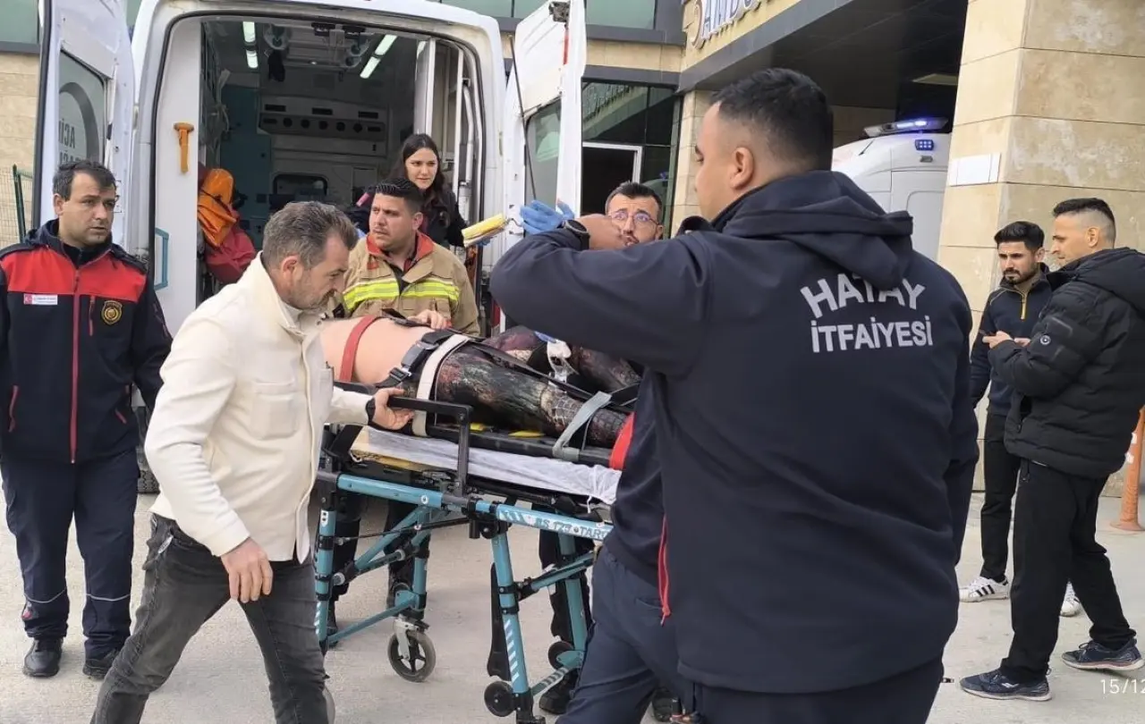 Balık avı kâbusa döndü! Zıpkın bacağına saplandı 3