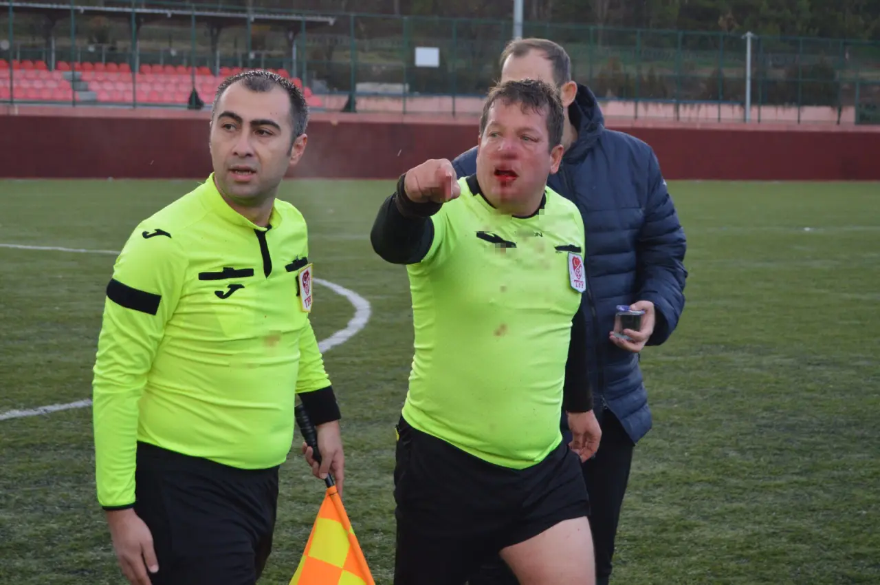 Eskişehir’de maç ortasında şiddet: Hakem kanlar içinde kaldı! 5