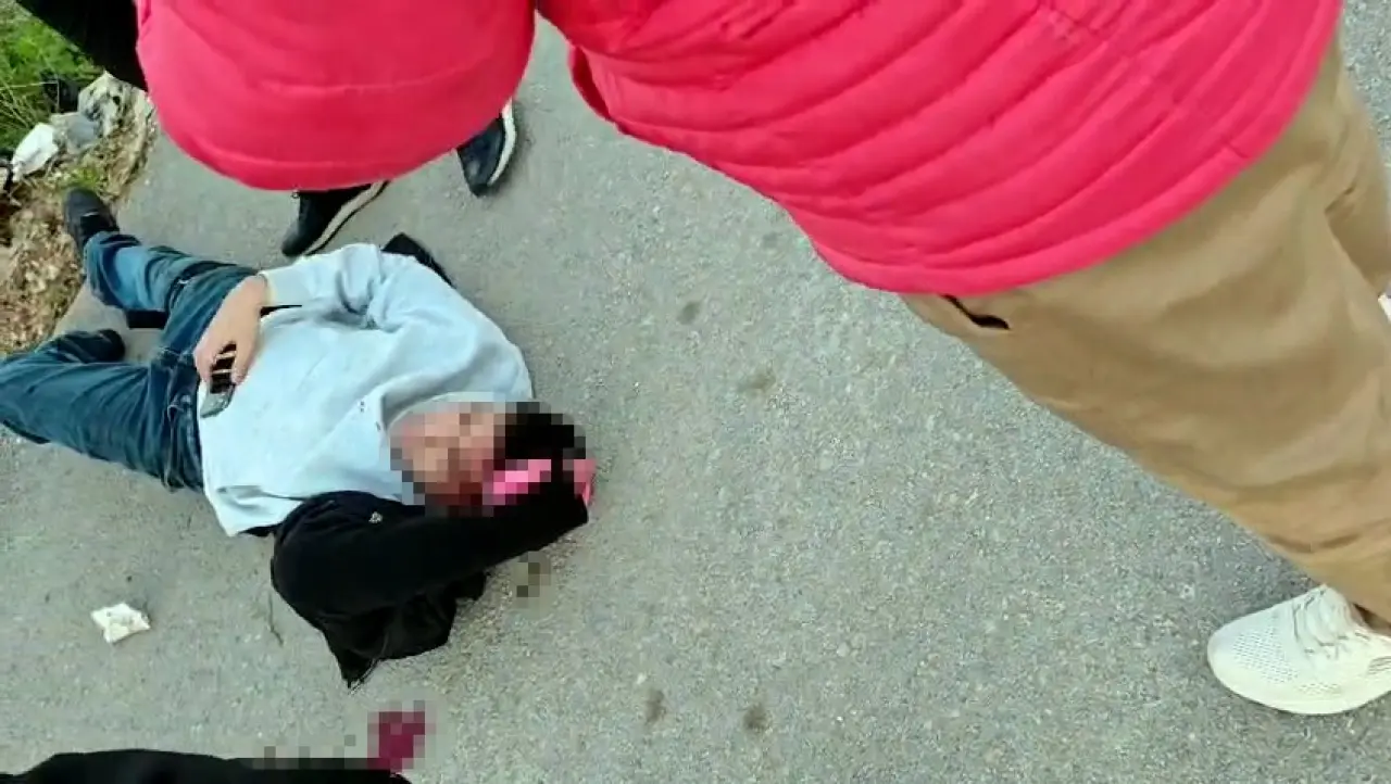 Tartışma kanla bitti! başından ve bacağından bıçaklandı 1