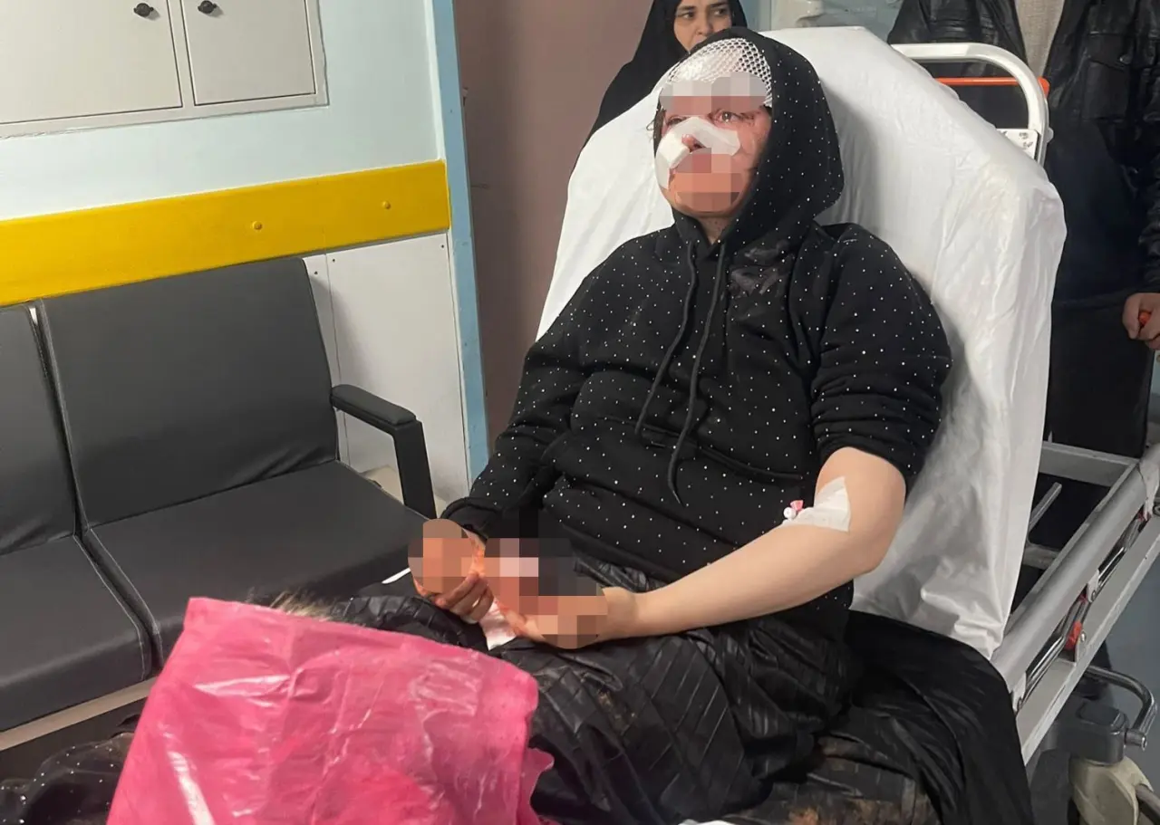 Gaziantep’te korkunç şiddet! Boşanmak isteyen karısını öldüresiye darp etti 3